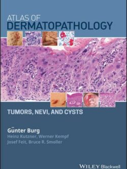 Atlas of Dermatopathology: Tumors, Nevi, and Cysts – eBook