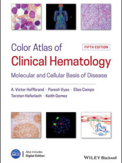 Color Atlas of Clinical Hematology: Molecular and Cellular Basis of Disease (5th Edition) – eBook
