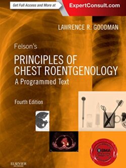Felson’s Principles of Chest Roentgenology (4th Edition) – eBook