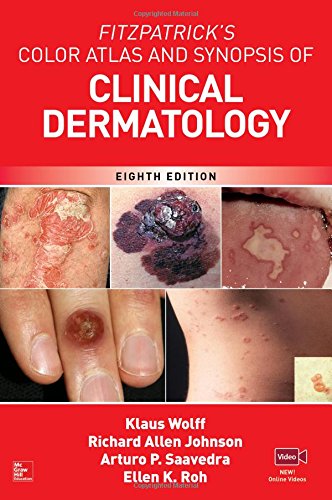Fitzpatrick’s Color Atlas and Synopsis of Clinical Dermatology (8th Edition) – eBook PDF