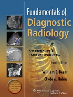 Fundamentals of Diagnostic Radiology (4th Edition) – In one volume – eBook