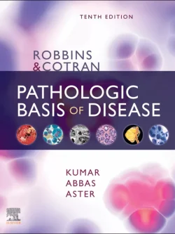 Robbins and Cotran Pathologic Basis of Disease (10th Edition) – PDF
