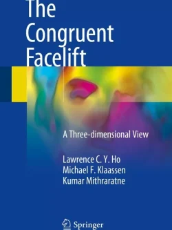 The Congruent Facelift: A Three-dimensional View – PDF